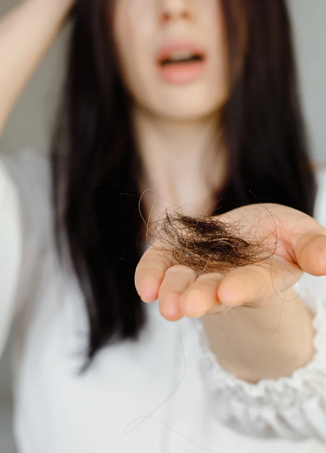 Woman holding strands of shed hair