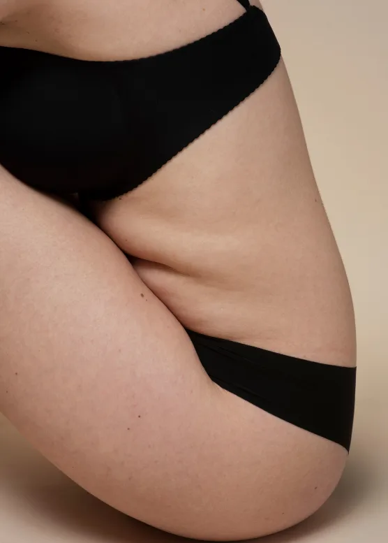 Loose skin on the upper arm