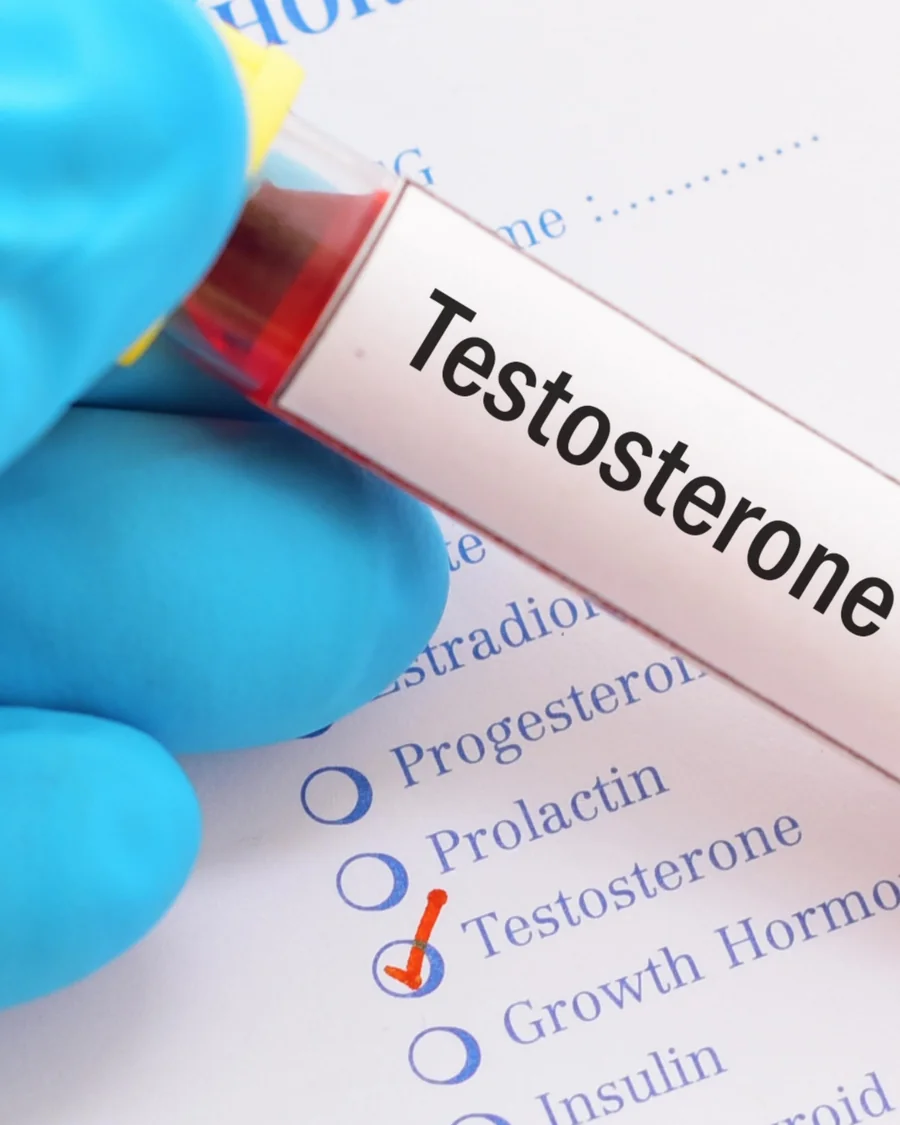 Testosterone blood sample and hormone laboratory form
