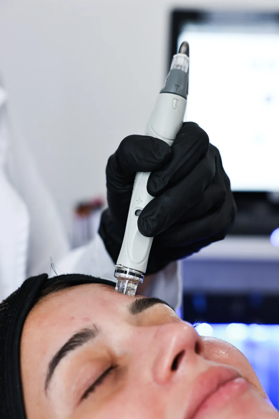 HydraFacial handpiece cleansing a patient’s skin at Advanced Aesthetics